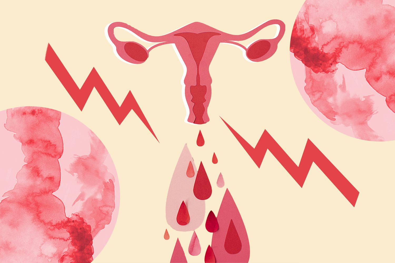 Menstrual cramps, Menstrual Health and Uterine Support