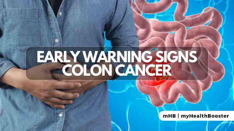 Early Warning Signs Colon Cancer