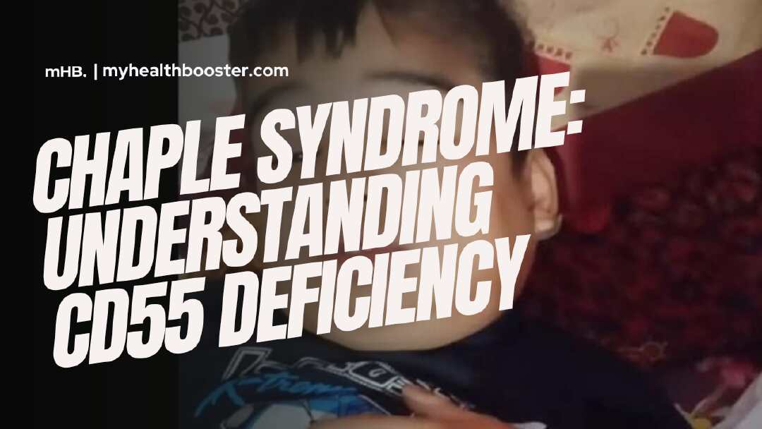 Chaple Syndrome Understanding CD55 Deficiency