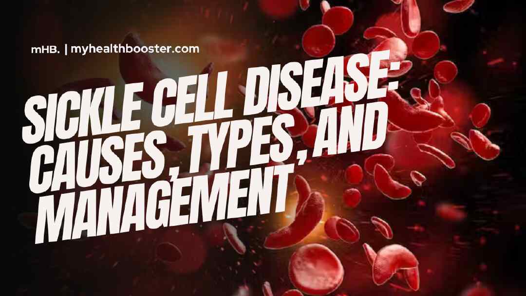 Sickle Cell Disease Causes, Types, and Management