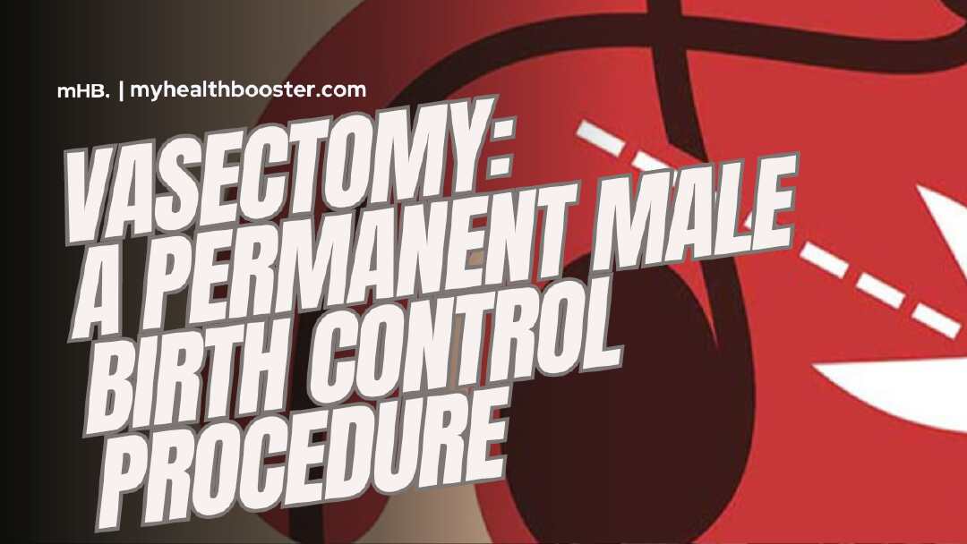 Vasectomy: A Permanent Male Birth Control Procedure