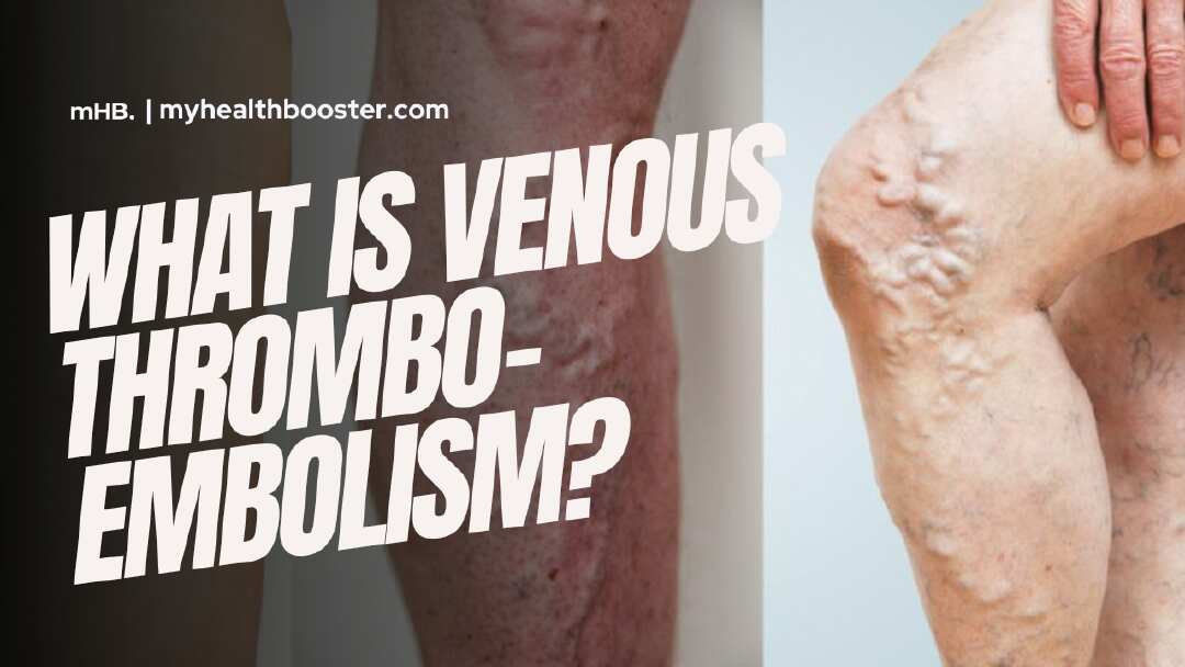What is Venous Thromboembolism