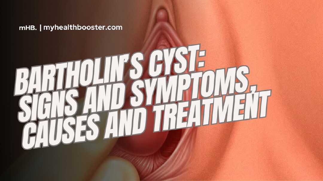 Bartholin’s Cyst and Abscess Signs and Symptoms, Causes and Treatment
