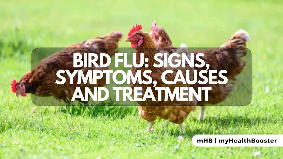 Bird Flu: Signs, Symptoms, Causes and Treatment