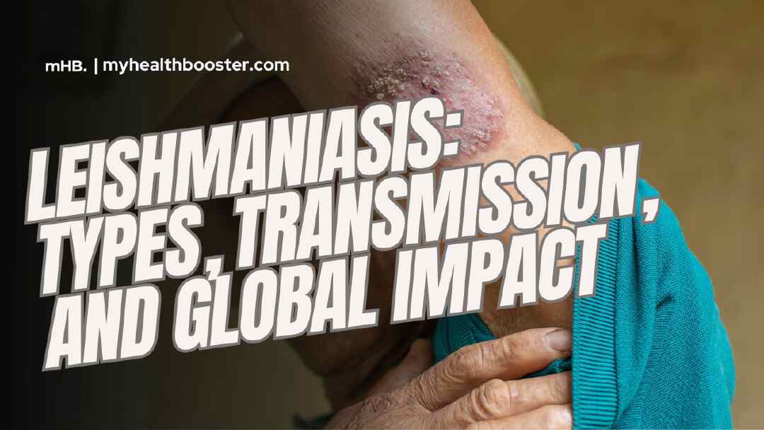 Leishmaniasis Types, Transmission, and Global Impact