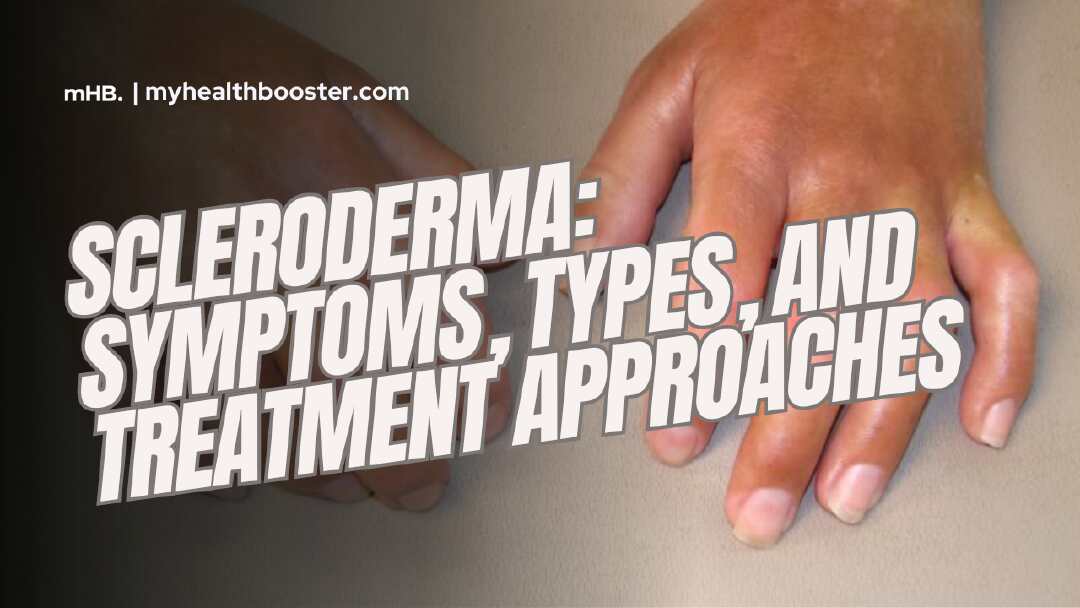 Scleroderma Symptoms, Types, and Treatment Approaches