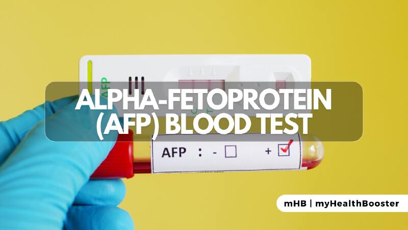 Alpha-Fetoprotein (AFP) Blood Test
