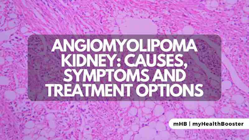 Angiomyolipoma Kidney – Causes, Symptoms and Treatment Options