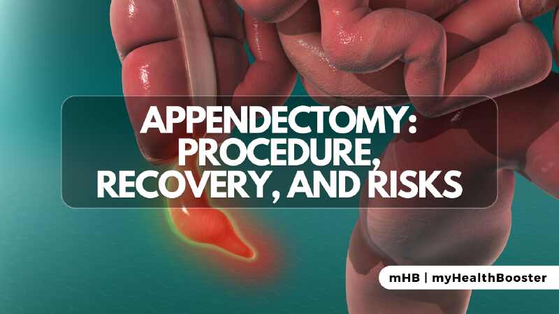 Appendectomy Procedure, Recovery, and Risks