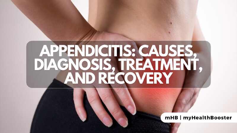 Appendicitis Causes, Diagnosis, Treatment, and Recovery