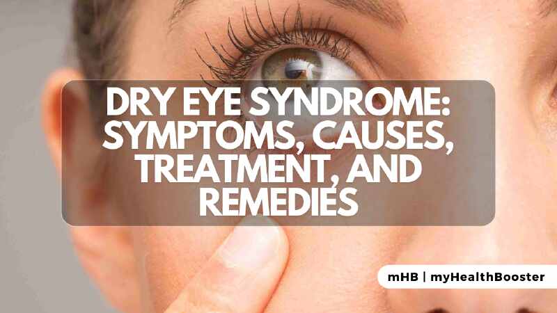 Dry Eye Syndrome Symptoms, Causes, Treatment, and Remedies