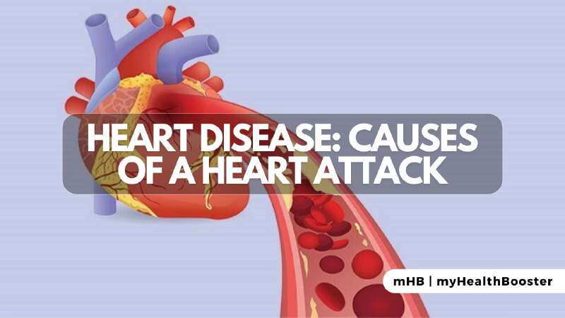 Heart Disease Causes of a Heart Attack
