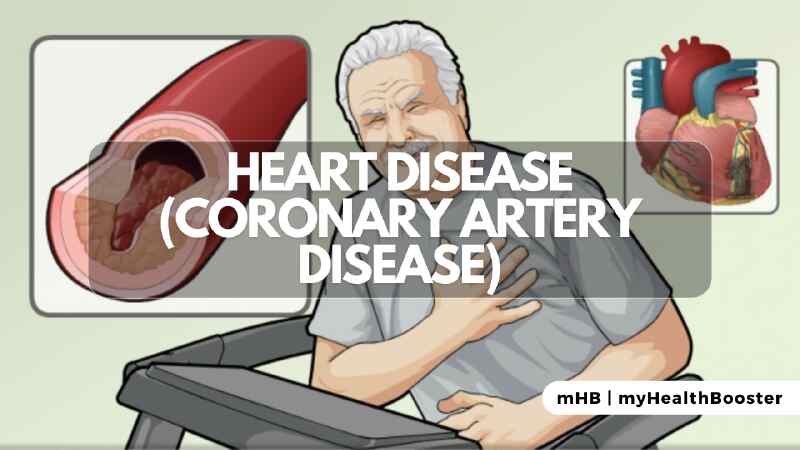 Heart Disease (Coronary Artery Disease)