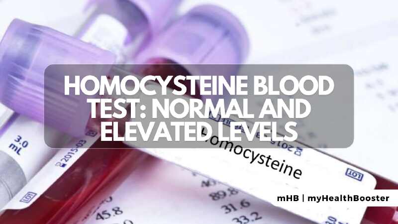 Homocysteine Blood Test: Normal and Elevated Levels