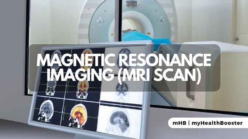 Magnetic Resonance Imaging (MRI Scan)