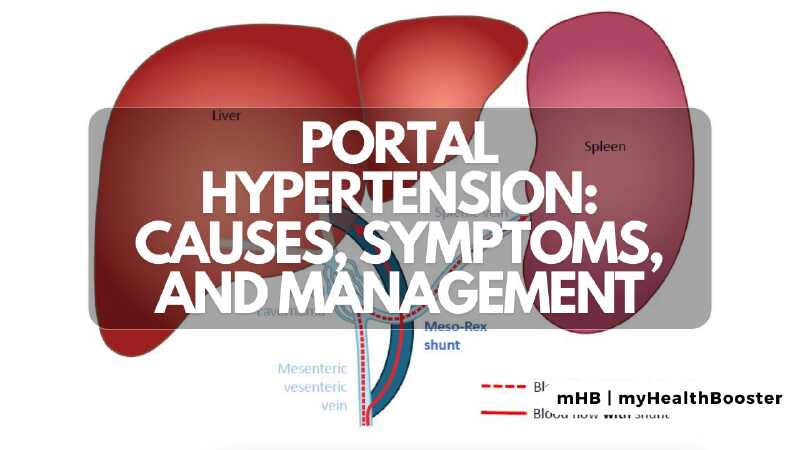 Portal Hypertension: Causes, Symptoms, Diagnosis, and Management