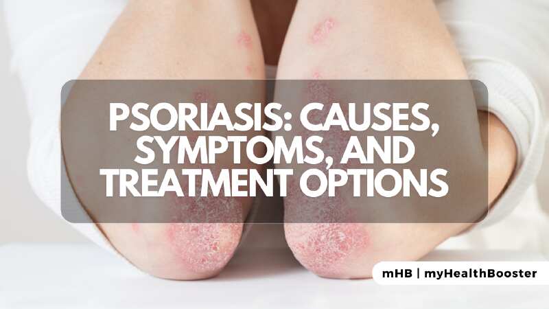Psoriasis: Causes, Symptoms, and Treatment Options