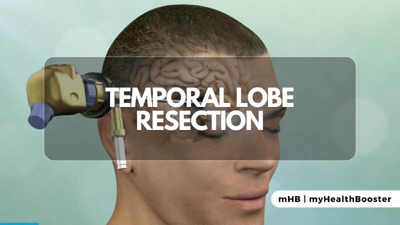 Temporal Lobe Resection