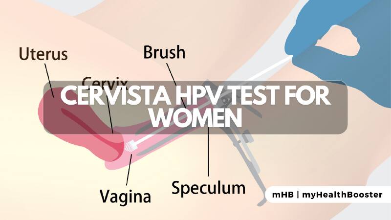 What is the Cervista HPV test?