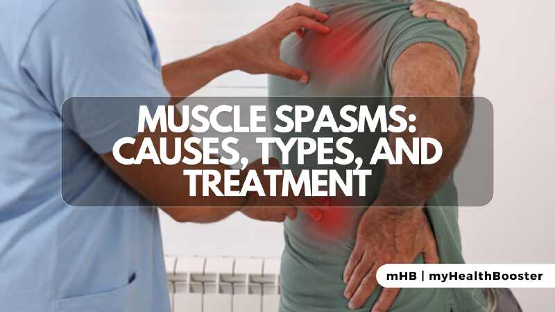 Muscle Spasms: Causes, Types, and Treatment
