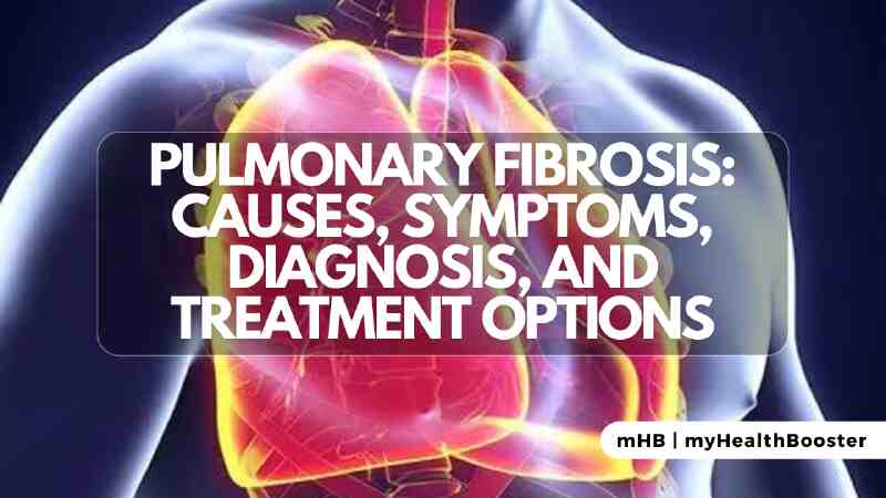 Pulmonary Fibrosis: Causes, Symptoms, Diagnosis, and Treatment Options
